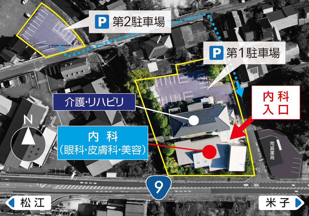 After image