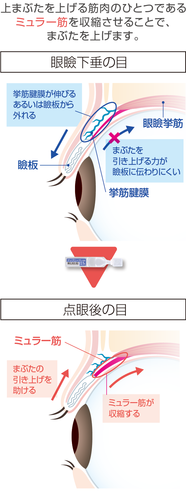 アップニーク®ミニ点眼液0.1％のはたらきのイメージ図