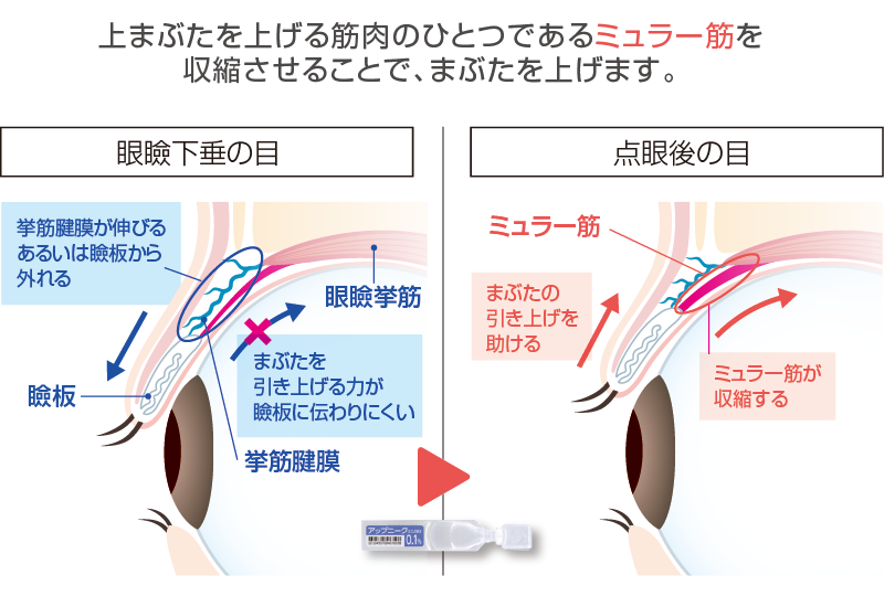 アップニーク®ミニ点眼液0.1％のはたらきのイメージ図
